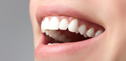 Whitening